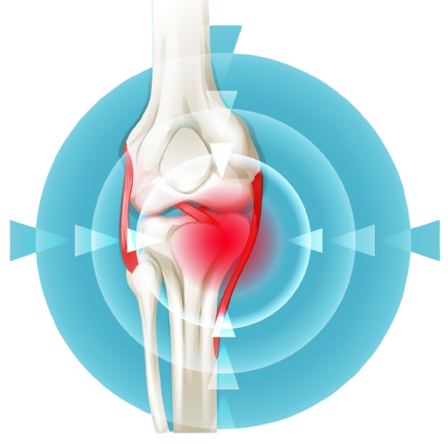 Knee Pain Illustration